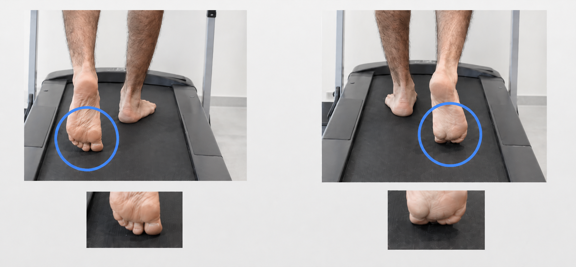 Analyse de marche sur tapis connecte
